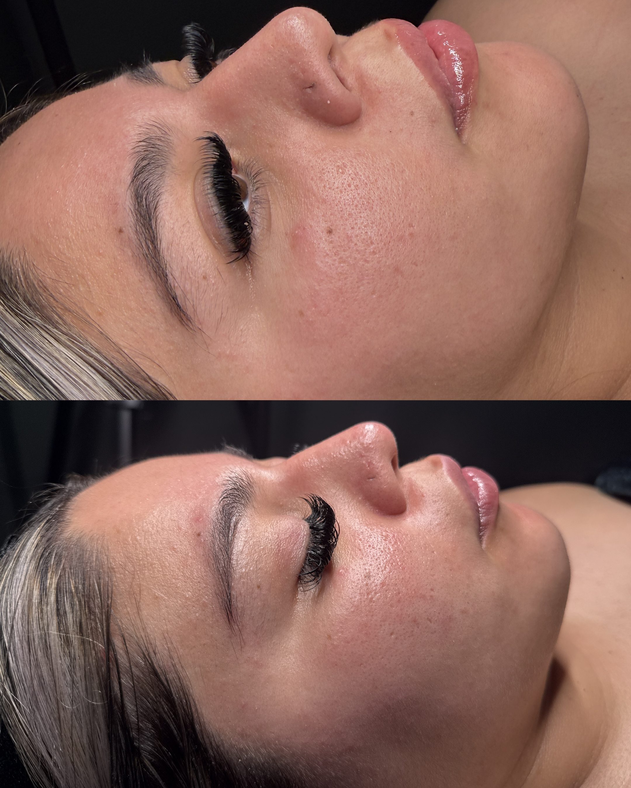 Skin before and after by Jazlyn