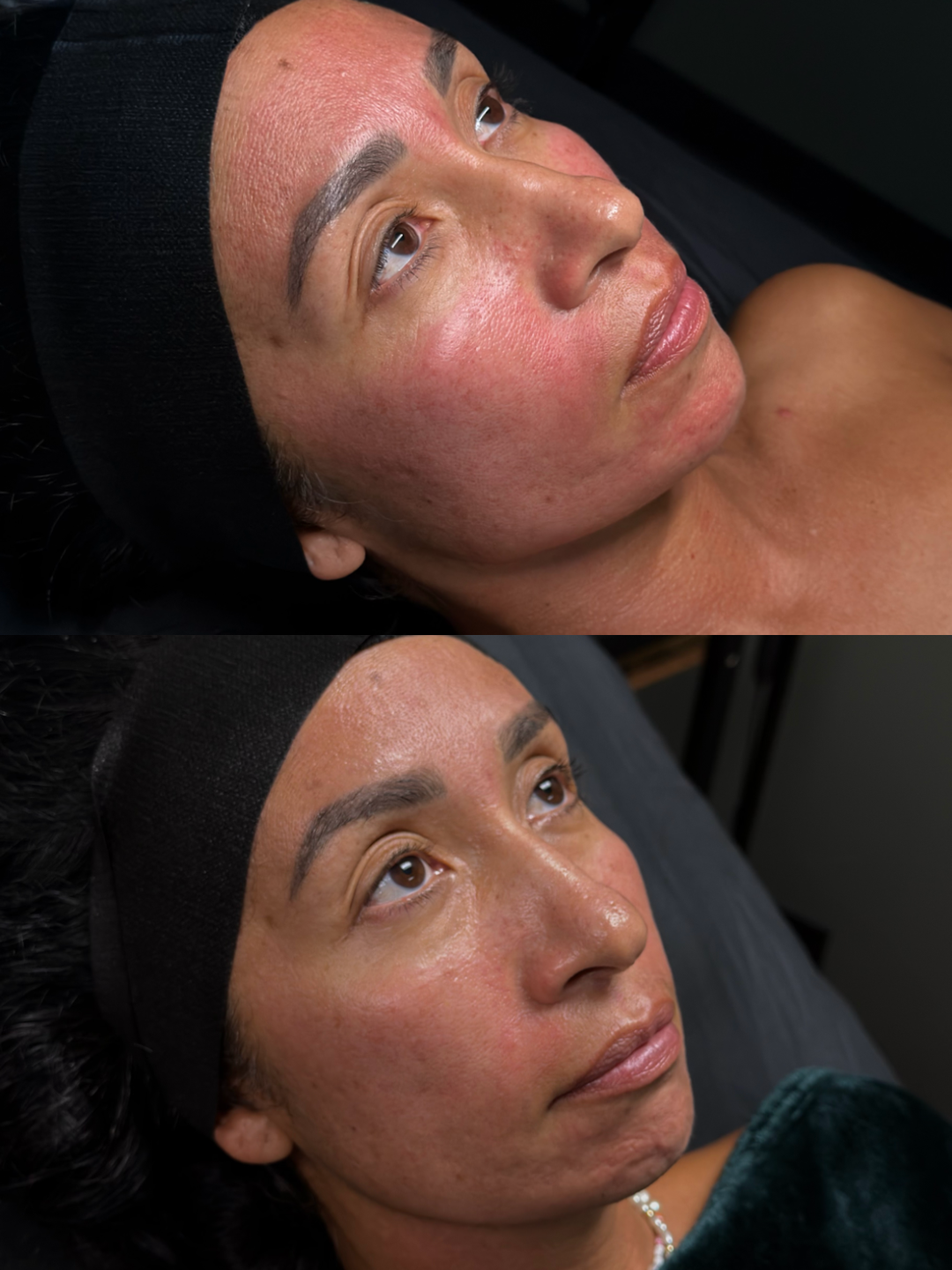 Skin before and after by Jazlyn