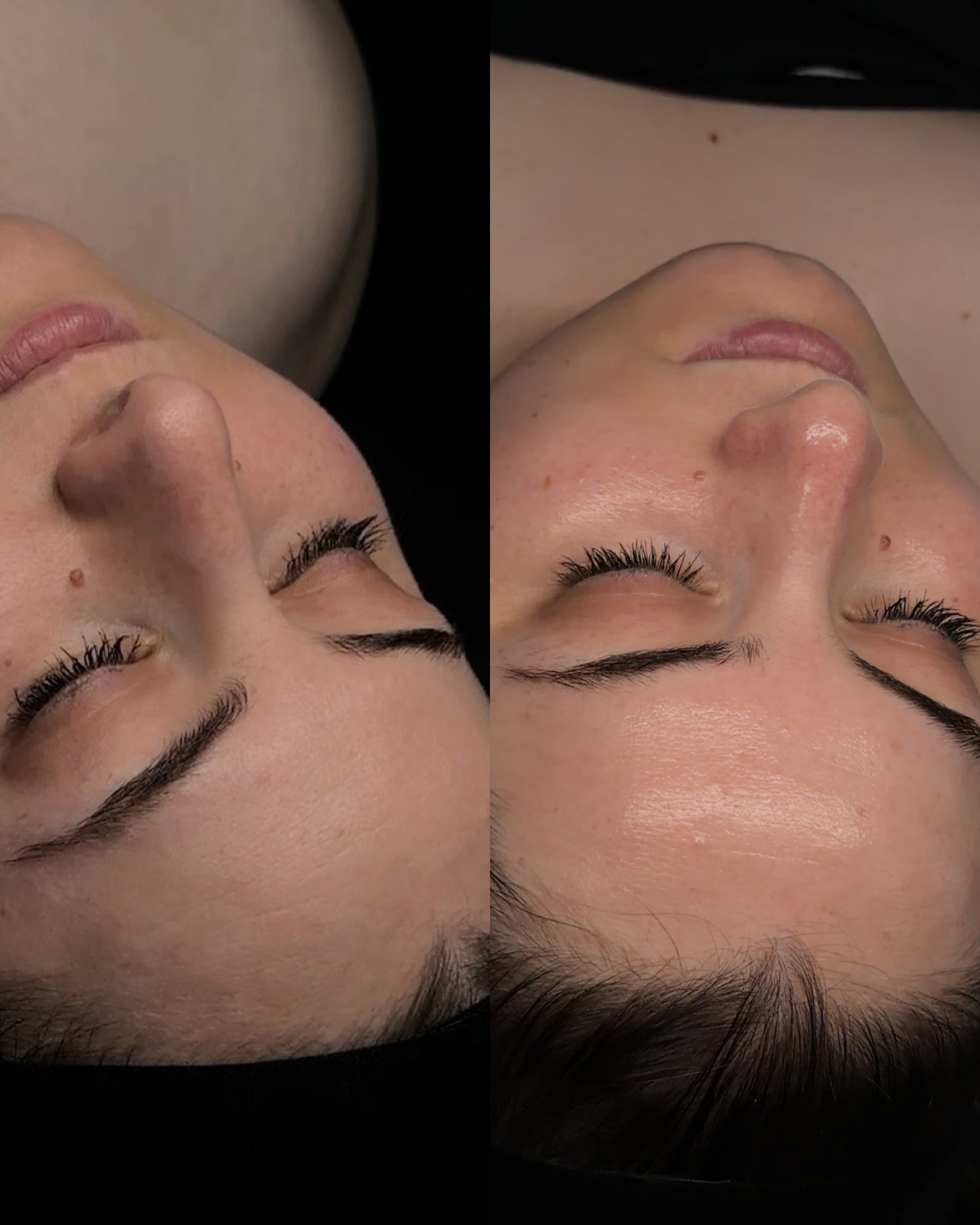 Skin before and after by Jazlyn
