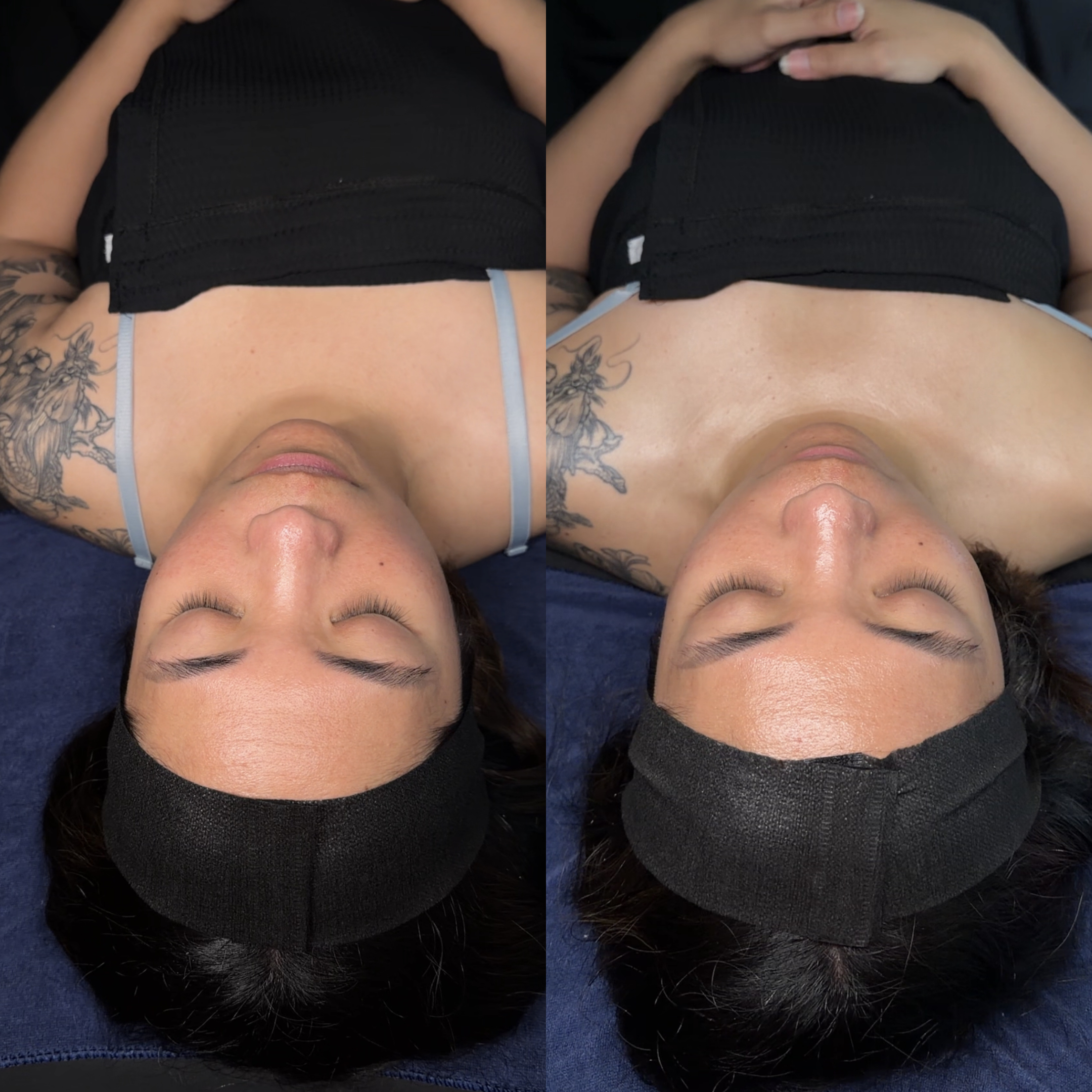 Skin before and after by Jazlyn